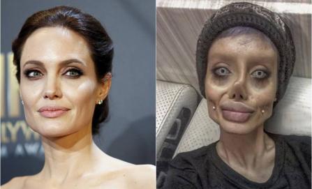 ¿Cincuenta cirugías para ser como Angelina Jolie?