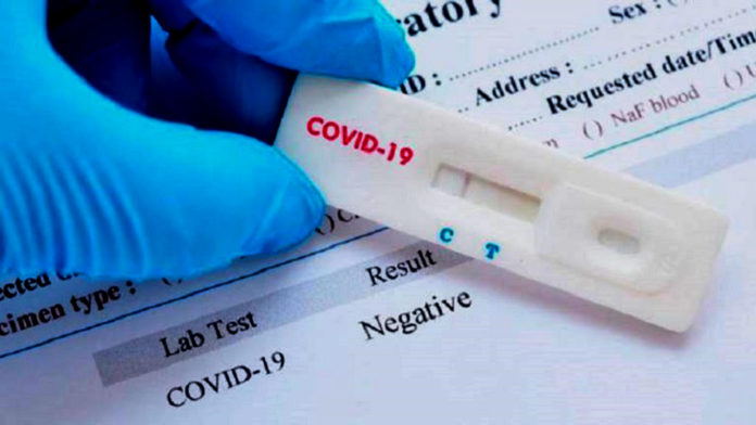 Se han aplicado más de mil 189 pruebas rápidas de Covid-19 en el estado