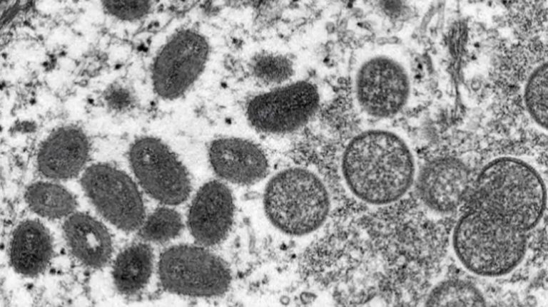 OMS eleva a 131 los casos confirmados de viruela del mono